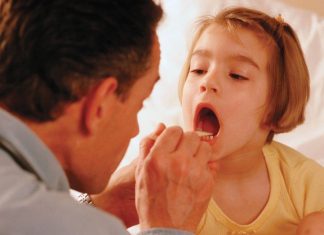 Totul despre amigdalita