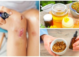 8 ingrediente naturale pe care le poti folosi pentru a calma ranile pielii