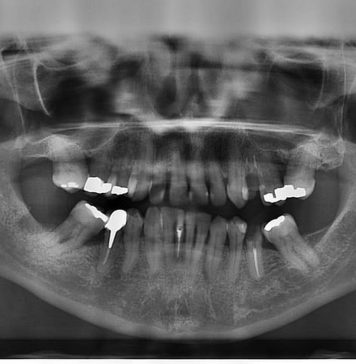 Cum se realizeaza radiografiile intr-o clinica dentara de top?