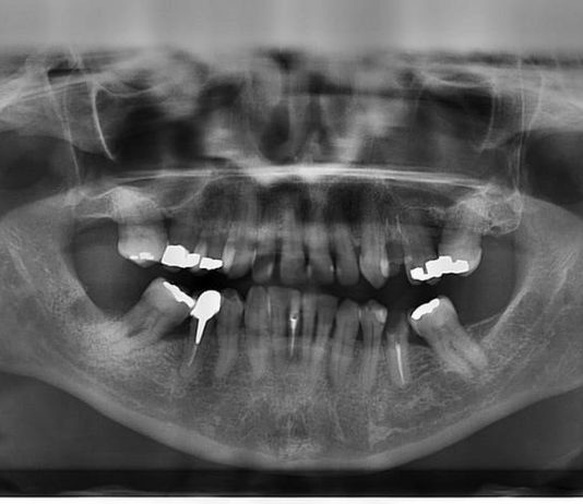 Cum se realizeaza radiografiile intr-o clinica dentara de top?
